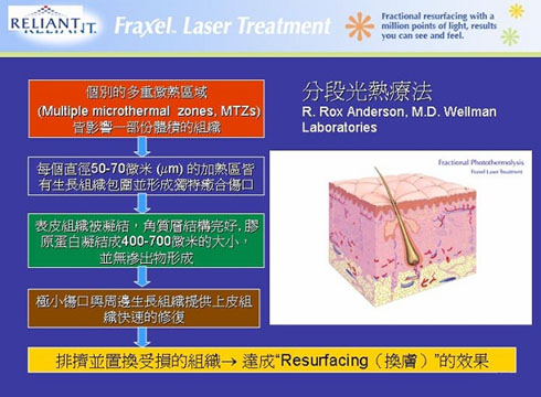 分段光熱療法（電波拉皮,無痛佳醫美人,自體脂肪隆乳佳醫松江店,植髮30年整形經歷內湖佳醫美人,肉毒桿菌專業板橋佳醫）